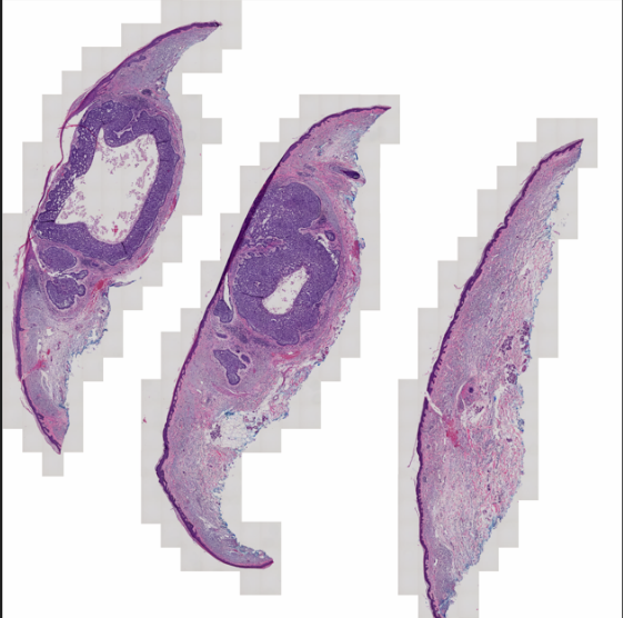 composition with mask