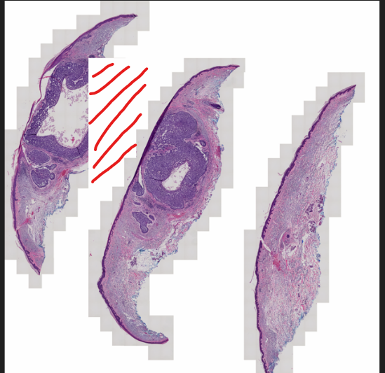 composition without mask